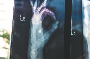 xray of a hand